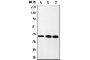 Western blot analysis of p35 expression in rat brain (A), HeLa (B), A431 (C) whole cell lysates. (CDK5R1 抗体  (N-Term))