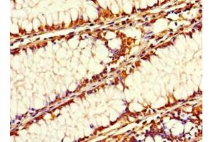 Immunohistochemistry (IHC) image for anti-Signal-Regulatory Protein beta 1 (SIRPB1) (AA 30-371) antibody (ABIN7169707)