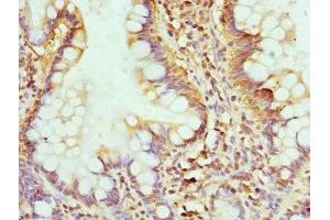 Immunohistochemistry of paraffin-embedded human small intestine tissue using ABIN7154289 at dilution of 1:100 (GMP Synthase 抗体  (AA 394-693))