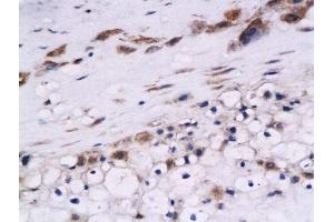 Formalin-fixed and paraffin embedded human placenta labeled with Anti-Cystatin B Polyclonal Antibody, Unconjugated  at 1:200 followed by conjugation to the secondary antibody and DAB staining (CSTB 抗体  (AA 51-98))