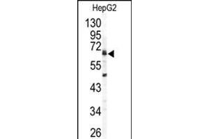 Western blot analysis of ARSB antibody (C-term) (ABIN391670 and ABIN2841581) in HepG2 cell line lysates (35 μg/lane). (Arylsulfatase B 抗体  (C-Term))