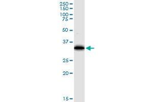 EEF1D monoclonal antibody (M04), clone 4B12. (EEF1D 抗体  (AA 1-91))