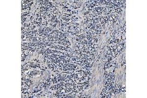IHC analysis of METTL1 using anti-METTL1 antibody (ABIN7600484). (METTL1 抗体  (AA 2-276))