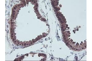 Immunohistochemical staining of paraffin-embedded Human breast tissue using anti-ACY1 mouse monoclonal antibody. (Aminoacylase 1 抗体)
