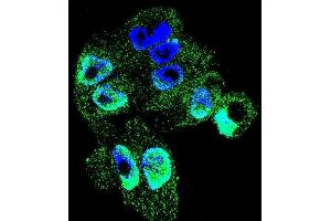 Confocal immunofluorescent analysis of TI Antibody (C-term) (ABIN655149 and ABIN2844770) with  cell followed by Alexa Fluor 488-conjugated goat anti-rabbit lgG (green). (TIMP1 抗体  (C-Term))