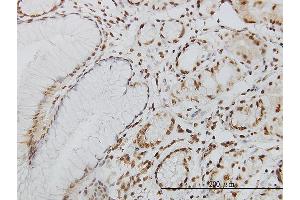 Immunoperoxidase of monoclonal antibody to POLK on formalin-fixed paraffin-embedded human stomach. (POLK 抗体  (AA 1-472))