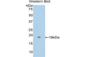 Detection of Recombinant TNFb, Mouse using Polyclonal Antibody to Tumor Necrosis Factor Beta (TNFb) (LTA 抗体  (AA 49-202))