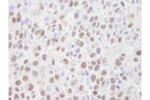Immunohistochemistry (IHC) image for anti-Histone Deacetylase 2 (HDAC2) (C-Term) antibody (ABIN7448973) (HDAC2 抗体  (C-Term))