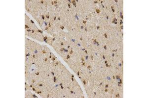 Immunohistochemistry (IHC) image for anti-Histone H4 (3meLys20) antibody (ABIN3016051) (Histone H4 抗体  (3meLys20))