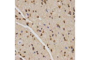 Immunohistochemistry (IHC) image for anti-Histone H4 (3meLys20) antibody (ABIN6219533) (Histone H4 抗体  (3meLys20))