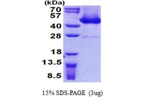 SDS-PAGE (SDS) image for alpha- and gamma-Adaptin Binding Protein (AAGAB) (AA 1-315) protein (His tag) (ABIN5852996)