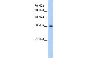 ELOVL7 antibody used at 1. (ELOVL7 抗体)