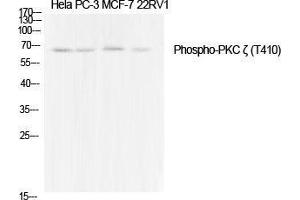 Western Blot (WB) analysis of specific cells using Phospho-PKC zeta (T410) Polyclonal Antibody. (PKC zeta 抗体  (pThr410))