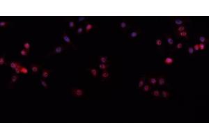 ABIN6266612 staining A-431 cells by IF/ICC. (p63 抗体  (C-Term))