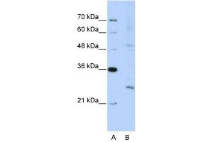 EXOSC4 antibody used at 5 ug/ml to detect target protein. (EXOSC4 抗体  (N-Term))