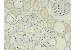 Immunohistochemistry of paraffin-embedded human kidney tissue using ABIN7159886 at dilution of 1:100 (TIMM1B (AA 1-103) 抗体)
