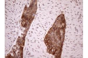 Immunohistochemistry (IHC) image for anti-Achalasia, Adrenocortical Insufficiency, Alacrimia (AAAS) (AA 322-546) antibody (ABIN2715861)