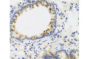 Immunohistochemistry of paraffin-embedded Rat lung using UVRAG Polyclonal Antibody at dilution of 1:100 (40x lens). (UVRAG 抗体)
