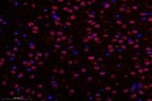 Immunofluorescent analysis of paraformaldehyde-fixed rat substantia nigra using TBXT (ABIN7075815) at dilution of 1: 600 (T-Box 19 抗体)