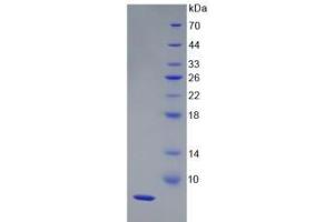 SDS-PAGE analysis of Human HPR Protein. (HPR 蛋白)
