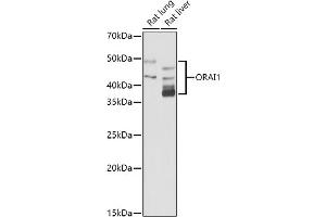 Western blot analysis of extracts of various cell lines, using (ABIN6130598, ABIN6145053, ABIN6145055 and ABIN6223281) at 1:1000 dilution. (ORAI1 抗体  (AA 202-301))