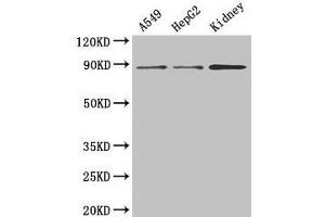Western Blot Positive WB detected in: A549 whole cell lysate, HepG2 whole cell lysate, Mouse kidney tissue All lanes: ASPH antibody at 3 μg/mL Secondary Goat polyclonal to rabbit IgG at 1/50000 dilution Predicted band size: 86, 35, 26, 24, 34, 84, 30, 22, 29, 33 kDa Observed band size: 86 kDa (Aspartate beta Hydroxylase 抗体  (AA 75-270))