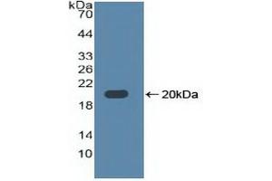 Detection of Recombinant TLR3, Human using Polyclonal Antibody to Toll Like Receptor 3 (TLR3) (TLR3 抗体  (AA 404-532))