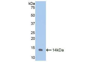 Western blot analysis of recombinant Goat MTNR1A. (Melatonin Receptor 1A 抗体  (AA 312-366))