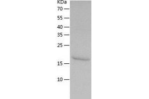 Western Blotting (WB) image for Tumor Necrosis Factor Receptor Superfamily, Member 1A (TNFRSF1A) (AA 22-212) protein (His tag) (ABIN7125553)