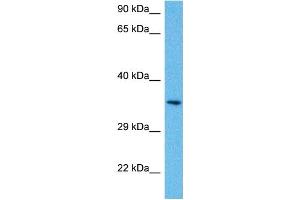 Host:  Mouse  Target Name:  PITX1  Sample Tissue:  Mouse Brain  Antibody Dilution:  1ug/ml (PITX1 抗体  (N-Term))