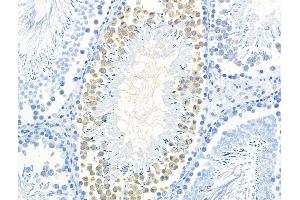 Phospho-Calsenilin/KCNIP3 (Ser63) Antibody at 1/100 staining Rat testis tissue by IHC-P. (DREAM 抗体  (pSer63))