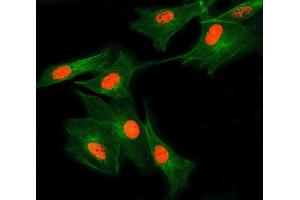 IF analysis of SNRNP27 and Tubulin beta using anti-SNRNP27 antibody (ABIN7599614) and anti-Tubulin beta antibody (ABIN7602744).