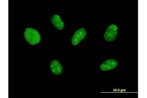 Immunofluorescence of purified MaxPab antibody to ZNF471 on Daoy cell. (ZNF471 抗体  (AA 1-626))