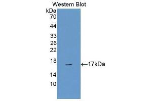 Western blot analysis of the recombinant protein. (Calcitonin Receptor 抗体  (AA 34-148))