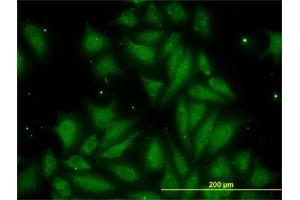 Immunofluorescence of monoclonal antibody to TIMP2 on HeLa cell. (TIMP2 抗体  (AA 27-220))