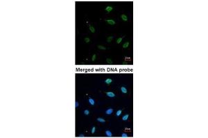 ICC/IF Image Immunofluorescence analysis of paraformaldehyde-fixed HeLa, using MCM7, antibody at 1:200 dilution. (MCM7 抗体)