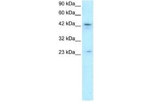 Human HepG2; WB Suggested Anti-ZNF365 Antibody Titration: 0. (ZNF365 抗体  (N-Term))