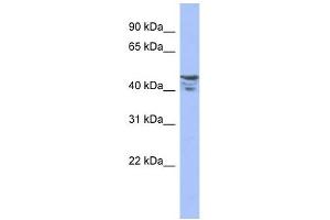 PRMT2 antibody used at 1 ug/ml to detect target protein. (PRMT2 抗体  (Middle Region))