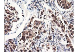 Image no. 8 for anti-F-Box Protein 21 (FBXO21) antibody (ABIN1498232) (FBXO21 抗体)