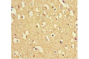 Immunohistochemistry of paraffin-embedded human brain tissue using ABIN7172010 at dilution of 1:100 (TXNDC9 抗体  (AA 1-188))