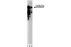 Western blot analysis of CRIK on Rat PC12 cell lysate (ATCC CRL-1721). (CIT 抗体  (AA 1420-1612))