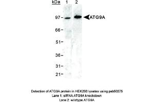 Image no. 1 for anti-ATG9 Autophagy Related 9 Homolog A (S. Cerevisiae) (ATG9A) (AA 750-839), (C-Term) antibody (ABIN363584) (ATG9A 抗体  (C-Term))