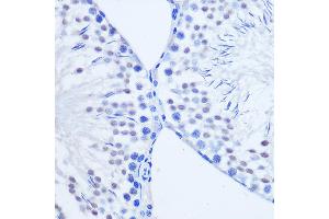Immunohistochemistry (IHC) image for anti-Aristaless Related Homeobox (ARX) (C-Term) antibody (ABIN7265673)