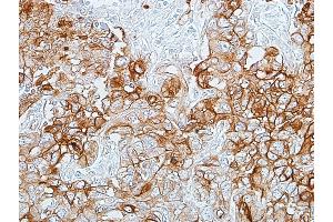 Immunohistochemistry (IHC) image for anti-Carcinoembryonic Antigen-Related Cell Adhesion Molecule 1 (CEACAM1) (AA 35-433) antibody (ABIN7455148)