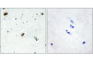 Immunohistochemistry (IHC) image for anti-C-Abl Oncogene 1, Non-Receptor tyrosine Kinase (ABL1) (AA 861-910) antibody (ABIN2889373) (ABL1 抗体  (AA 861-910))
