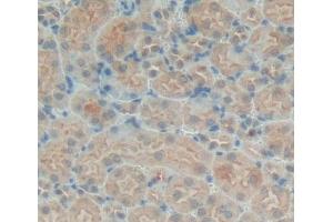 Used in DAB staining on fromalin fixed paraffin- embedded kidney tissue (PTPN21 抗体  (AA 983-1176))