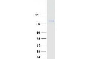 Western Blotting (WB) image for NDC80 Kinetochore Complex Component Homolog (NDC80) protein (Myc-DYKDDDDK Tag) (ABIN2726911)