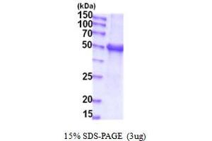 SDS-PAGE (SDS) image for UDP Glucuronosyltransferase 1 Family, Polypeptide A1 (UGT1A1) (AA 26-490) protein (His tag) (ABIN5854140) (UGT1A1 Protein (AA 26-490) (His tag))