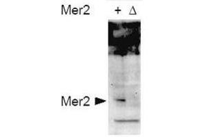 Western blot using  affinity purified anti-S. (CD151 抗体  (pSer30))