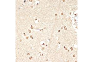 Immunohistochemistry of paraffin-embedded human brain using Histone H2A Rabbit mAb (ABIN7267703) at dilution of 1:100 (40x lens).